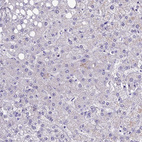 Immunohistochemical staining of human liver shows no positivity in hepatocytes as expected.