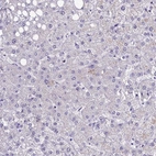 Immunohistochemical staining of human liver shows no positivity in hepatocytes as expected.