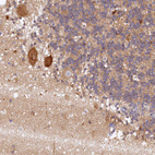 Immunohistochemical staining of human cerebellum shows moderate cytoplasmic positivity in Purkinje cells.