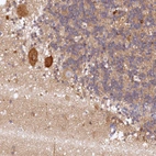 Immunohistochemical staining of human cerebellum shows moderate cytoplasmic positivity in Purkinje cells.