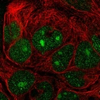Immunofluorescent staining of human cell line CACO-2 shows localization to nucleus & nucleoli.