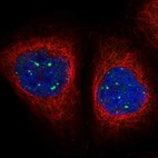 Immunofluorescent staining of human cell line A-431 shows localization to nuclear bodies.