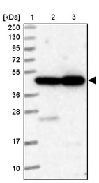 Lane 1: Marker [kDa] 250, 130, 95, 72, 55, 36, 28, 17, 10_br/_Lane 2: Human cell line RT-4_br/_Lane 3: Human cell line U-251MG sp