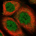 Immunofluorescent staining of human cell line A-431 shows localization to nucleoplasm & cytosol.