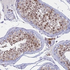 Immunohistochemical staining of human testis shows high expression.
