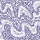 Immunohistochemical staining of human endometrium shows low expression as expected.