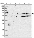 Lane 1: Marker [kDa] 250, 130, 95, 72, 55, 36, 28, 17, 10_br/_Lane 2: Human cell line RT-4_br/_Lane 3: Human cell line U-251MG sp_br/_Lane 4: Human plasma (IgG/HSA depleted)_br/_Lane 5: Human liver tissue_br/_Lane 6: Human tonsil tissue