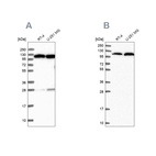 Western blot analysis using Anti-AARS antibody HPA040870 (A) shows similar pattern to independent antibody HPA044223 (B).