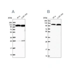 Western blot analysis using Anti-AARS antibody HPA040870 (A) shows similar pattern to independent antibody HPA044223 (B).