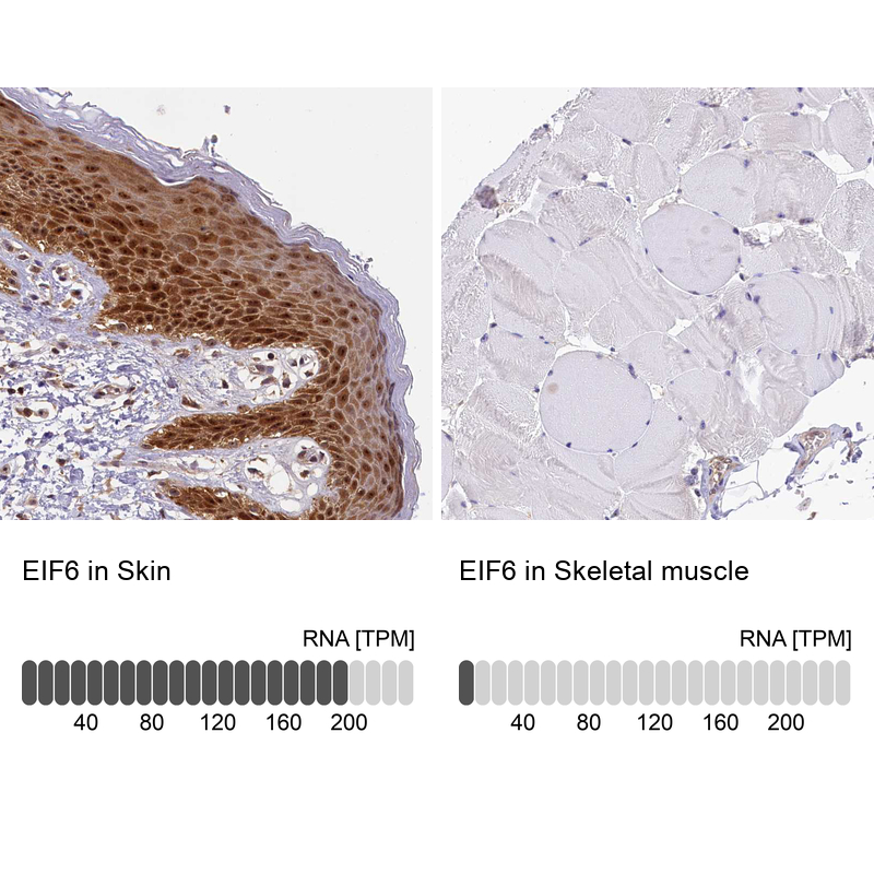 Anti-EIF6 Antibody