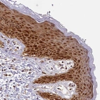 Immunohistochemical staining of human Skin shows strong nuclear and cytoplasmic positivity in squamous epithelial cells.