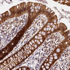 Immunohistochemical staining of human Colon shows strong nuclear and cytoplasmic positivity in glandular cells.