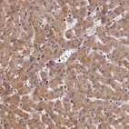 Immunohistochemical staining of human Liver shows strong cytoplasmic positivity in hepatocytes.
