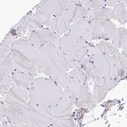 Immunohistochemical staining of human Skeletal muscle shows very weak cytoplasmic positivity in myocytes.