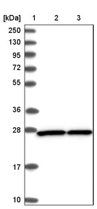 Lane 1: Marker [kDa] 250, 130, 95, 72, 55, 36, 28, 17, 10_br/_Lane 2: Human cell line RT-4_br/_Lane 3: Human cell line U-251MG sp