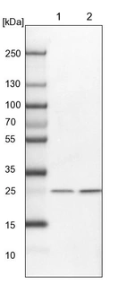 Lane 1: NIH-3T3 cell lysate (Mouse embryonic fibroblast cells)_br/_Lane 2: NBT-II cell lysate (Rat Wistar bladder tumour cells)
