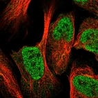Immunofluorescent staining of human cell line U-2 OS shows localization to nucleoplasm.