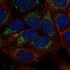 Immunofluorescent staining of human cell line MCF7 shows localization to mitochondria.