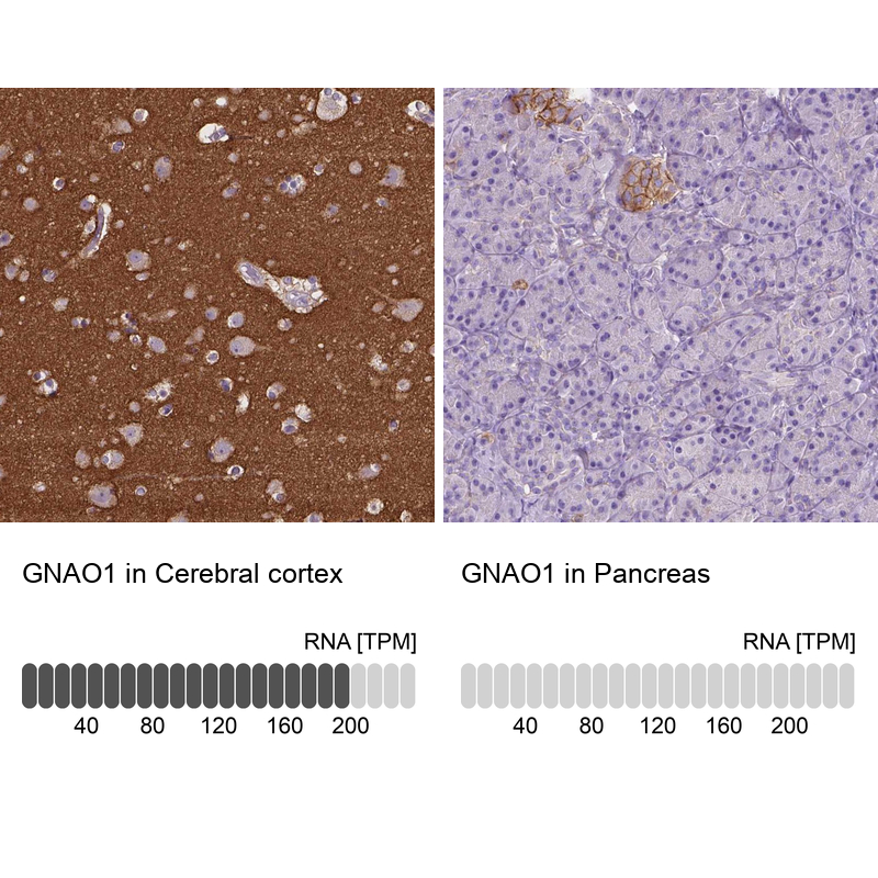 Anti-GNAO1 Antibody
