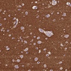 Immunohistochemical staining of human cerebral cortex shows high expression.