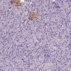 Immunohistochemical staining of human pancreas shows low expression as expected.
