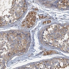 Anti-ARL11 Antibody