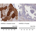 Anti-ANKRD2 Antibody