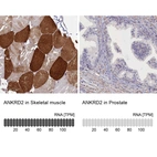 Anti-ANKRD2 Antibody