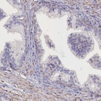 Immunohistochemical staining of human prostate shows low expression as expected.