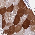 Immunohistochemical staining of human skeletal muscle shows high expression.