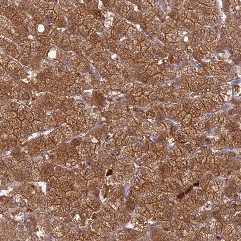 Anti-PGBD4 Antibody
