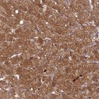 Anti-PGBD4 Antibody