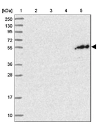 Lane 1: Marker [kDa] 250, 130, 95, 72, 55, 36, 28, 17, 10_br/_Lane 2: Human cell line RT-4_br/_Lane 3: Human cell line U-251MG sp_br/_Lane 4: Human plasma (IgG/HSA depleted)_br/_Lane 5: Human liver tissue
