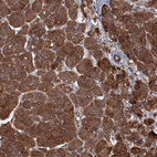 Immunohistochemical staining of human pancreas shows strong cytoplasmic positivity in exocrine glandular cells.