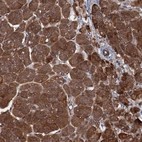 Immunohistochemical staining of human pancreas shows strong cytoplasmic positivity in exocrine glandular cells.