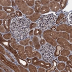 Immunohistochemical staining of human kidney shows strong cytoplasmic positivity in cells in tubules.