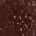 Anti-ADAT1 Antibody