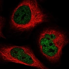 Immunofluorescent staining of human cell line U-2 OS shows localization to nucleoplasm.