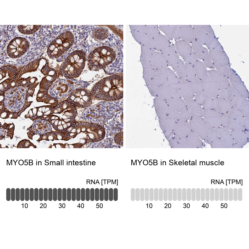 Anti-MYO5B Antibody