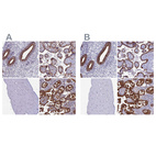 Immunohistochemical staining of human endometrium, placenta, skeletal muscle and small intestine using Anti-MYO5B antibody HPA040902 (A) shows similar protein distribution across tissues to independent antibody HPA040593 (B).