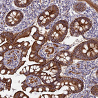 Immunohistochemical staining of human small intestine shows membranous and cytoplasmic positivity in glandular cells.