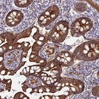 Immunohistochemical staining of human small intestine shows membranous and cytoplasmic positivity in glandular cells.
