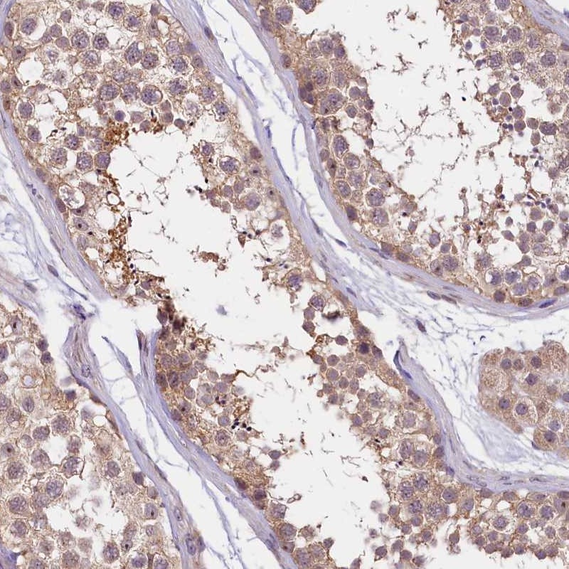 Anti-UBXN6 Antibody