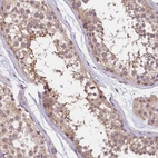 Anti-UBXN6 Antibody
