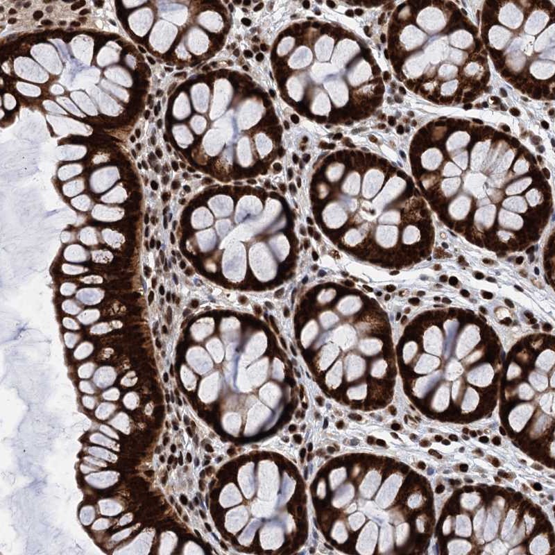 Anti-PPP4R1 Antibody