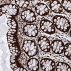 Anti-PPP4R1 Antibody