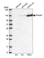 Western blot analysis in U2OS cells transfected with control siRNA, target specific siRNA probe #1 and #2, using Anti-PPP4R1 antibody. Remaining relative intensity is presented.