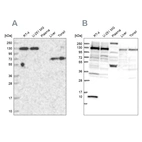 Western blot analysis using Anti-PPP4R1 antibody HPA040905 (A) shows similar pattern to independent antibody HPA041089 (B).