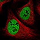 Immunofluorescent staining of human cell line U-2 OS shows localization to nucleoplasm.