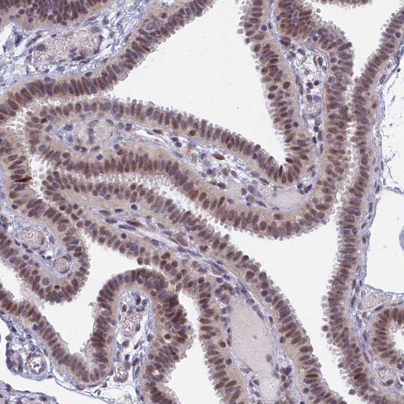 Anti-DNAJC17 Antibody